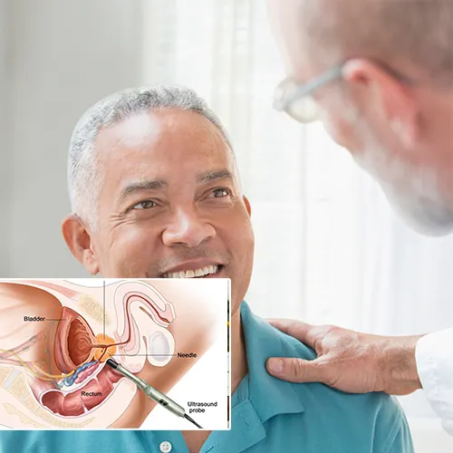 Scheduling Your Penile Implant Consultation